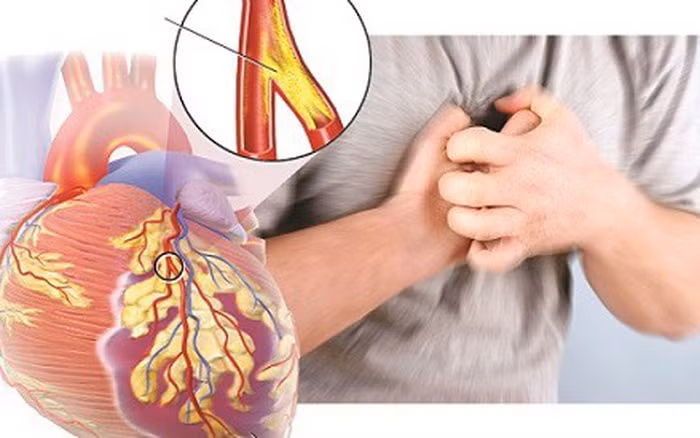 Kinh hoàng: Thuốc lá giết hơn 100 người Việt mỗi ngày - Hình 3 Kinh hoang: Thuoc la giet hon 100 nguoi Viet moi ngay-Hinh-3