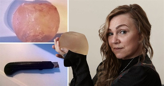 Nữ bệnh nhân kiêm bác sĩ Tonia Rossington.