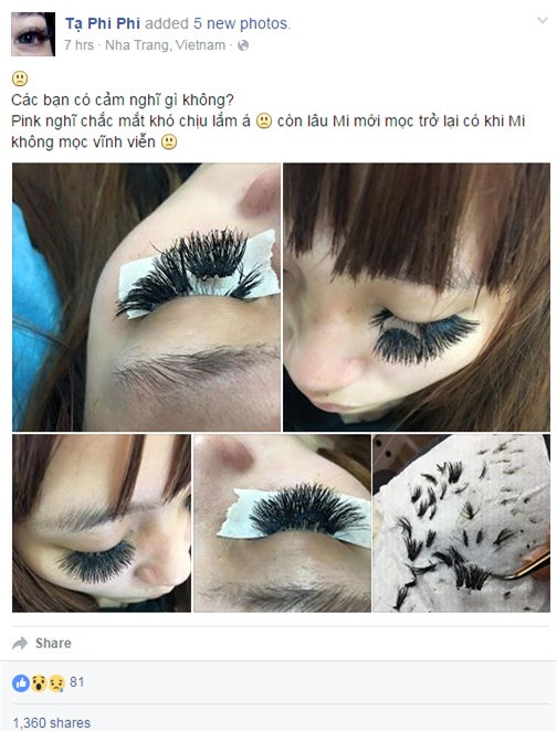 Hàng lông mi sau khi được nối trông có khác gì cái chổi? Không chỉ chọn loại mi cứng ngắc nhìn rất giả, "tác giả" của hàng mi này còn chấm keo dày, ẩu tạo ra những cục vón bết trên hàng mi thật của khách hàng.