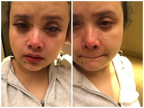 Mới đây, hình ảnh của cô gái có tên Siakap Keli đến từ Malaysia đăng tải trên mạng xã hội cũng khiến chị em phải suy nghĩ lại về việc nối mi giả ngay lập tức. Tiền mất tật mang, cô gái nối mi giả nhưng mất luôn mi thật trông vừa thảm vừa hài hước.