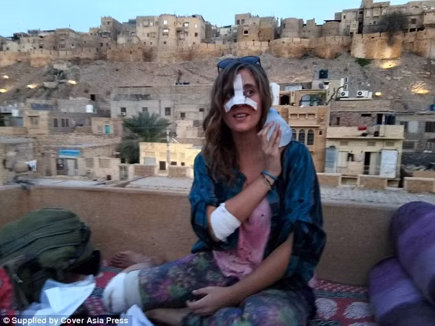 Mellisa Meville chằng chịt các vết thương sau khi bị tấn công.