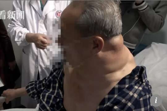 Ông Tan bắt đầu khó thở do những khối u - Ảnh: SCMP.