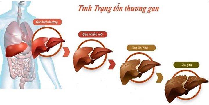 Độc tính gan: Liều lượng lô hội lớn có thể dẫn đến viêm gan. Sự hiện diện của nhiều hợp chất hoạt tính sinh học như C-glycosides, anthraquinon, anthone, lectins, polymannans và acetylated mannans trong lô hội có thể ảnh hưởng đến quá trình giải độc của gan và điều này có thể dẫn đến tổn thương gan.