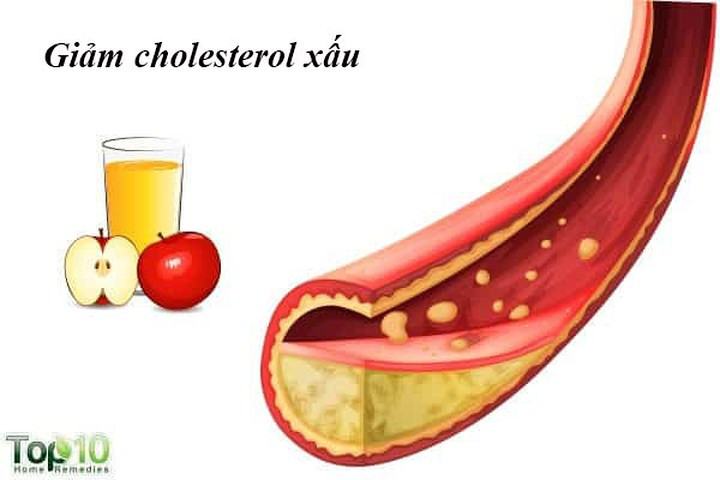 Giảm cholesterol xấu: Phụ nữ sau khi mãn kinh có nguy cơ có nhiều cholesterol xấu nhiều hơn do tuổi tác cũng như những thay đổi nội tiết tố liên quan đến thời kỳ mãn kinh. Thời kỳ mãn kinh cũng làm tăng nguy cơ mắc bệnh tim ở phụ nữ. Để kiểm soát mức LDL của bạn, bạn có thể sử dụng giấm táo. Giấm táo giúp giảm tổng lượng cholesterol và chất béo trung tính do hàm lượng axit axetic có trong nó.