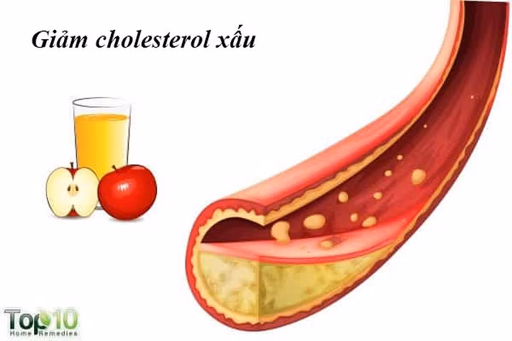Giảm cholesterol xấu: Phụ nữ sau khi mãn kinh có nguy cơ có nhiều cholesterol xấu nhiều hơn do tuổi tác cũng như những thay đổi nội tiết tố liên quan đến thời kỳ mãn kinh. Thời kỳ mãn kinh cũng làm tăng nguy cơ mắc bệnh tim ở phụ nữ. Để kiểm soát mức LDL của bạn, bạn có thể sử dụng giấm táo. Giấm táo giúp giảm tổng lượng cholesterol và chất béo trung tính do hàm lượng axit axetic có trong nó.