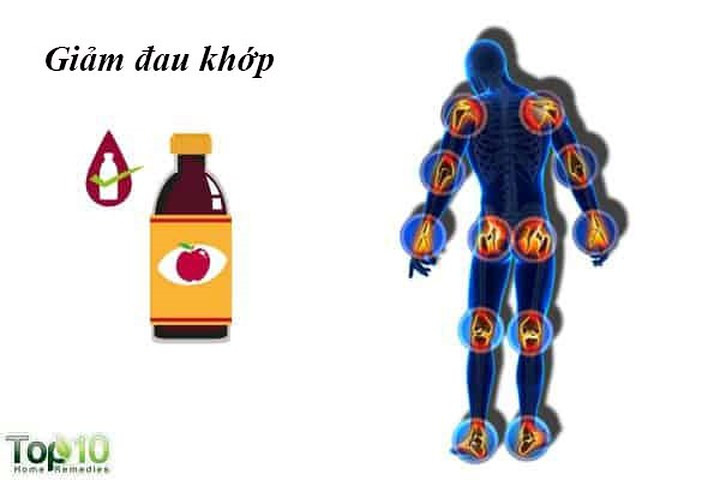 Giảm đau khớp: Viêm khớp là một rối loạn khớp trong đó một hoặc nhiều khớp bị viêm. Để đối phó với các triệu chứng liên quan đến viêm khớp như đau, cứng khớp, viêm, sưng và đỏ trên các khớp bị ảnh hưởng, giấm táo rất hiệu quả. Nó có đặc tính chống viêm và kiềm tạo ra sự thoải mái bằng cách giảm đau và cứng ở các khớp.