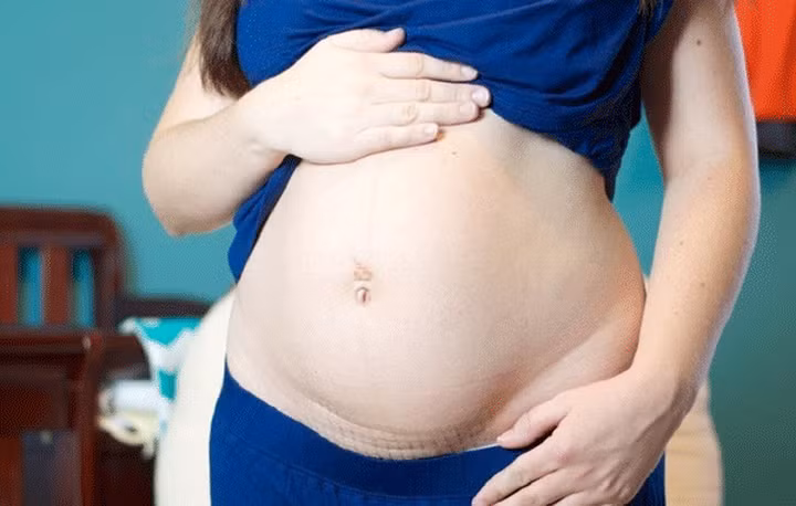 Nhiễm trùng: Bất kỳ vết thương phẫu thuật cũng có nguy cơ nhiễm trùng. Trong điều kiện được chăm sóc tốt, bệnh nhân vẫn luôn có nguy cơ nhiễm trùng từ vết mổ.