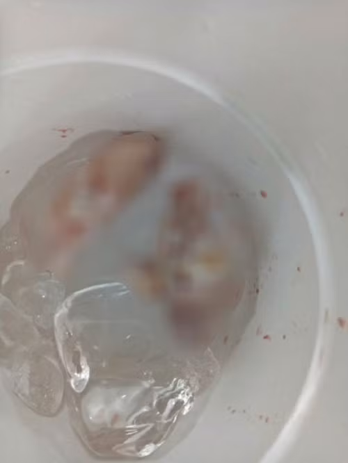 3 ngón tay được ngâm trong thùng đá lạnh. Ảnh: Người lao động.