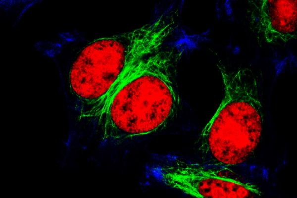 Phát hiện của các nhà khoa học Mỹ mở ra một cơ hội mới để điều chỉnh đột biến p53-R175H bằng cách phát triển các thuốc ức chế protein USP15 - Ảnh: Shutterstock