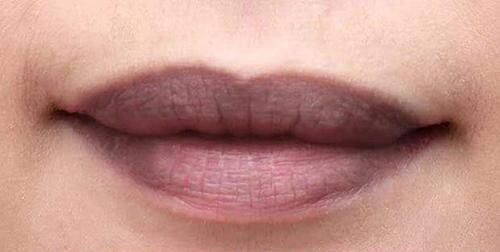 Môi thâm khiến ngoại hình chị em trở nên xấu đi vài phần.