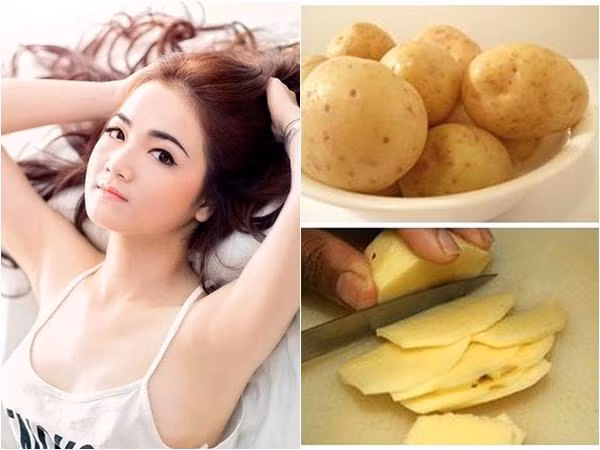 Những lát khoai tây sẽ giúp bạn dưỡng trắng vùng nách hiệu quả.