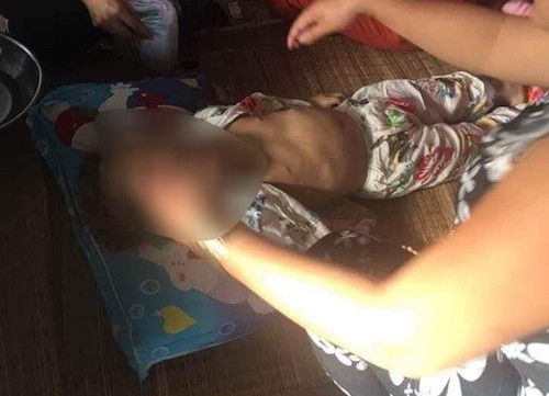 Hình ảnh bé gái nghi bị bạo hành được chia sẻ trên mạng. Ảnh: CAND