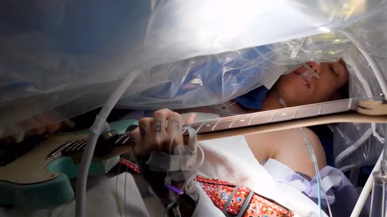 Benh nhan choi dan khi dang mo u nao-Hinh-2