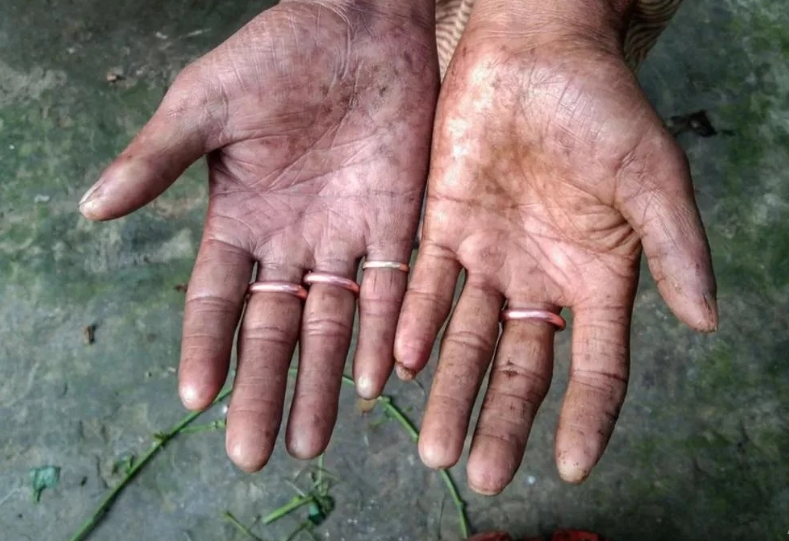 Noi kho cua nhung nguoi khong co dau van tay