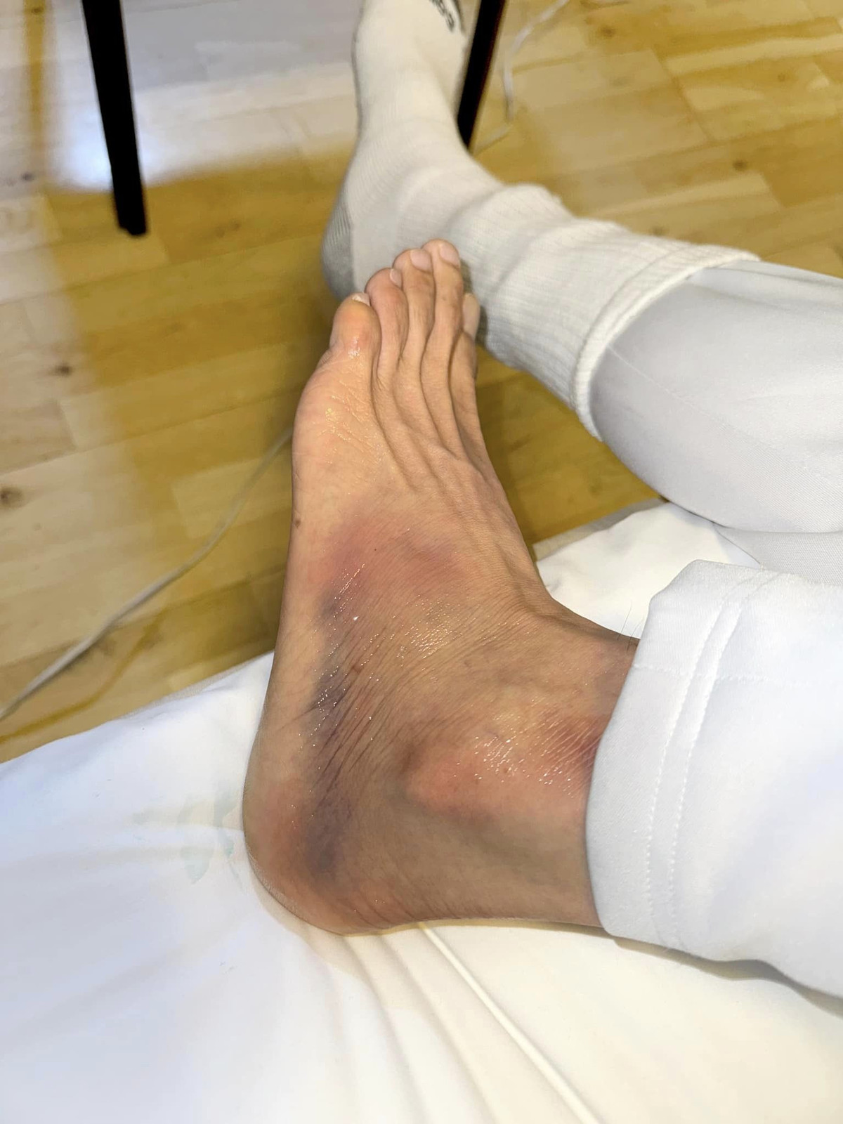 Ca si Dan Truong bi nga cau thang-Hinh-2