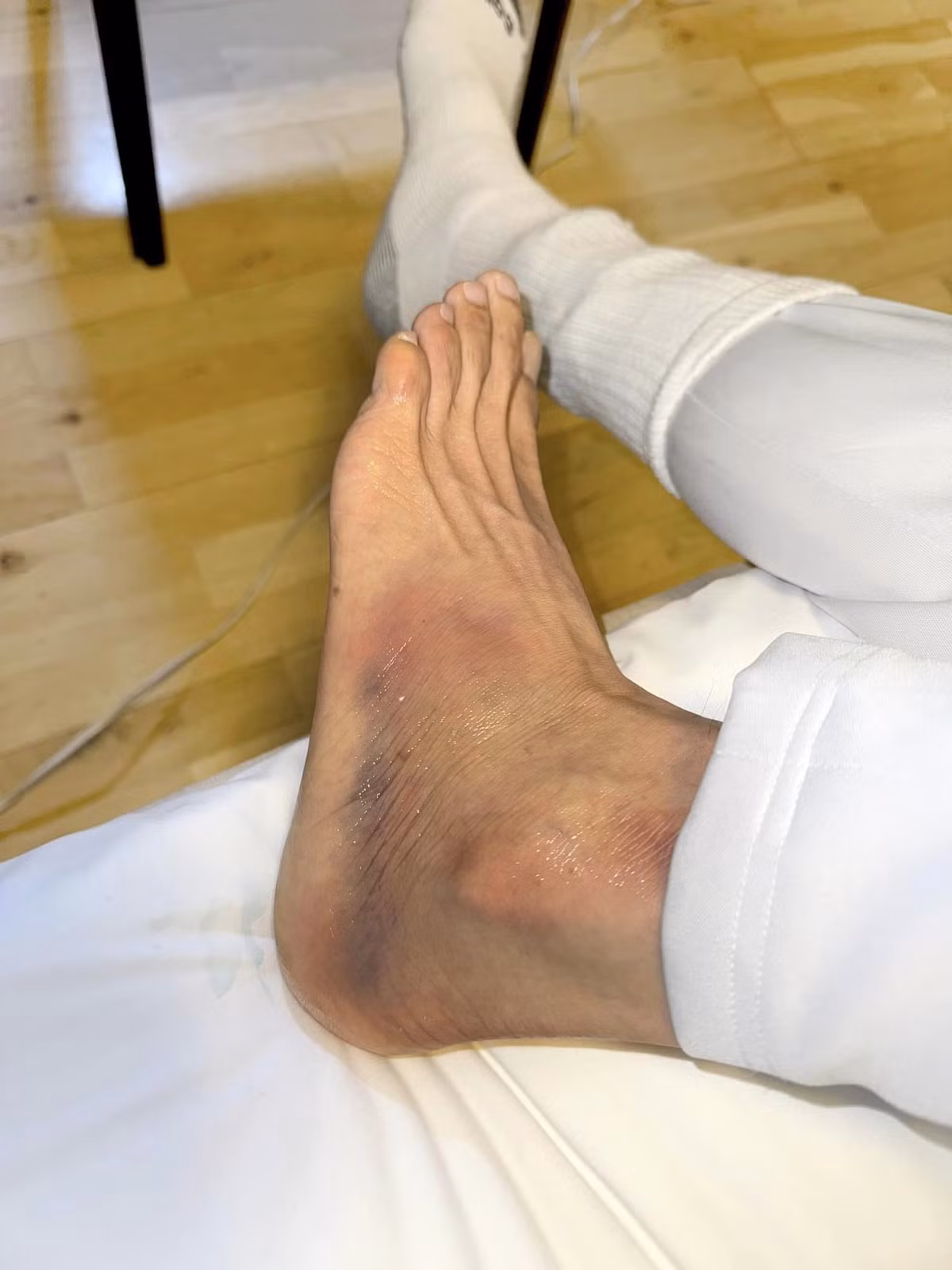 Ca si Dan Truong bi nga cau thang-Hinh-2