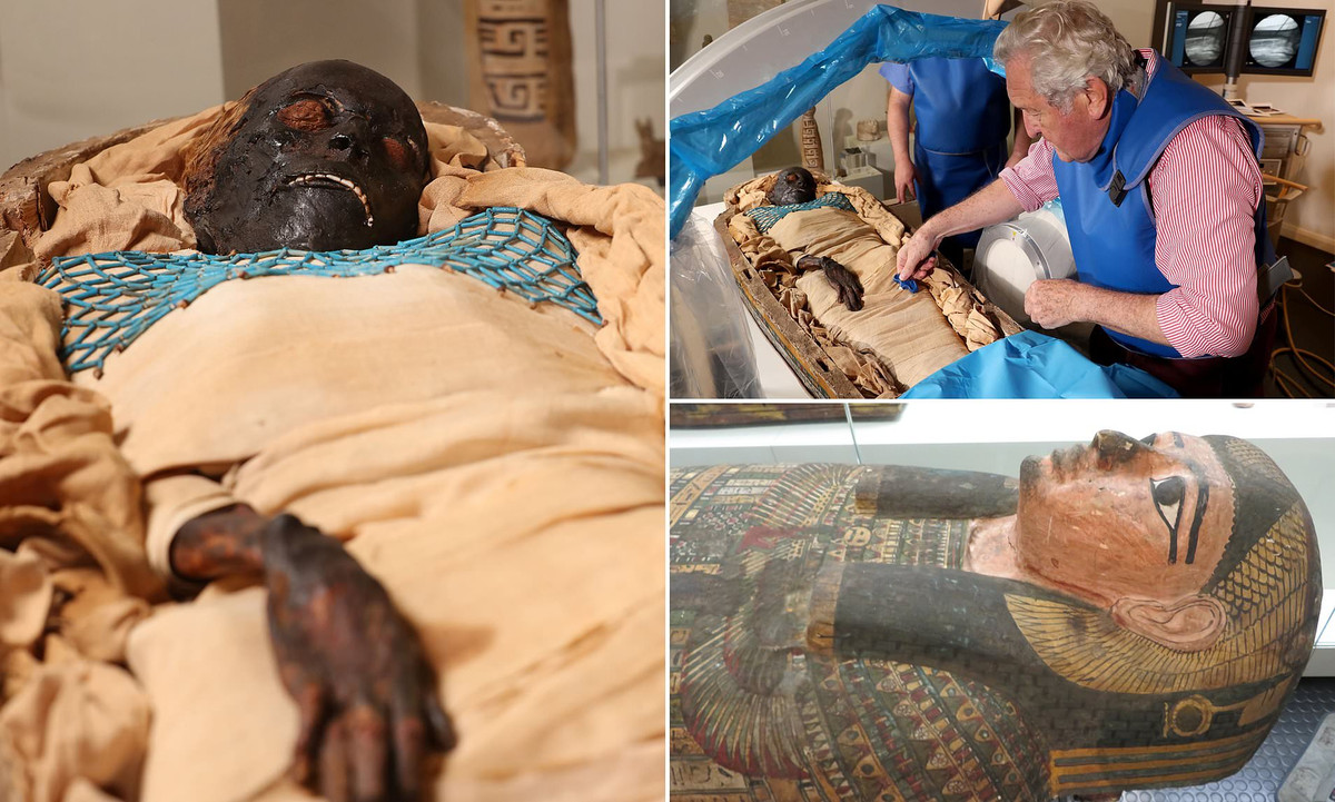 Hai là, Takabut có một đốt sống phụ. Nghiên cứu của các chuyên ra chỉ ra có 2% dân số thế giới gặp tình trạng này.