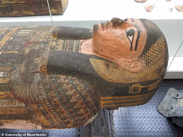 Theo đó, Takabut là một trong số 0,02% người trên thế giới có 33 chiếc răng.