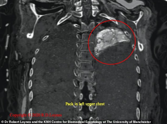 Thông qua nghiên cứu mới đây, các chuyên gia phát hiện xác ướp Takabut ở trong tình trạng khá tốt, tóc xoăn và có màu nua vàng.