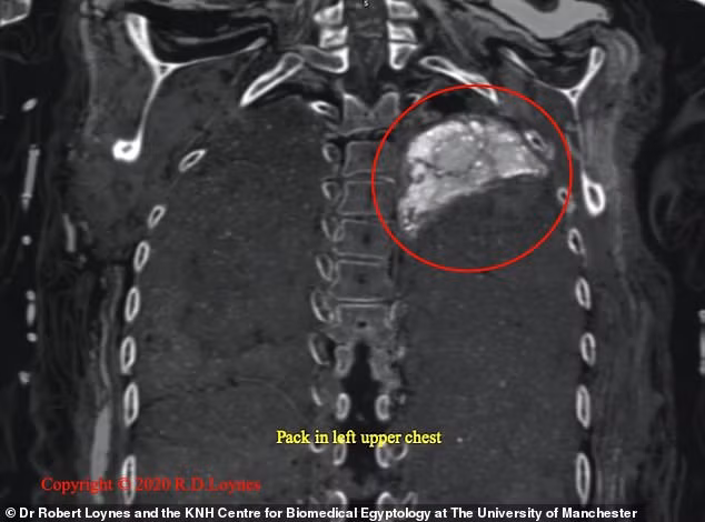 Thông qua nghiên cứu mới đây, các chuyên gia phát hiện xác ướp Takabut ở trong tình trạng khá tốt, tóc xoăn và có màu nua vàng.