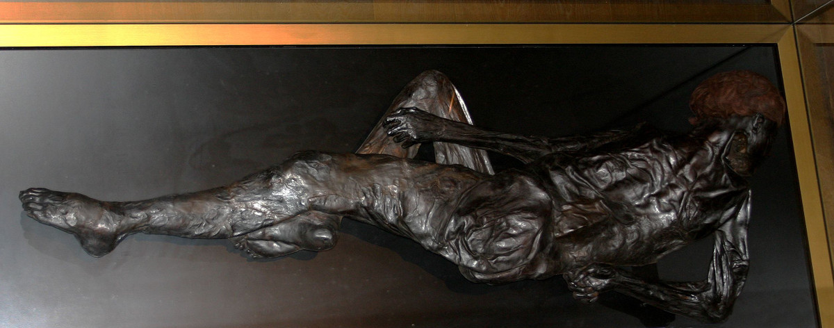 Xác ướp Grauballe có rất nhiều vết thương trên cơ thể, đặc biệt là vết cắt tự cổ họng đến tai và thiếu 4 đốt xương thắt lưng. Điều này khiến các chuyên gia nghi ngờ người này có thể là một tù nhân chiến tranh nên bị giết một cách hung bạo hoặc là nạn nhân một vụ hiến tế.