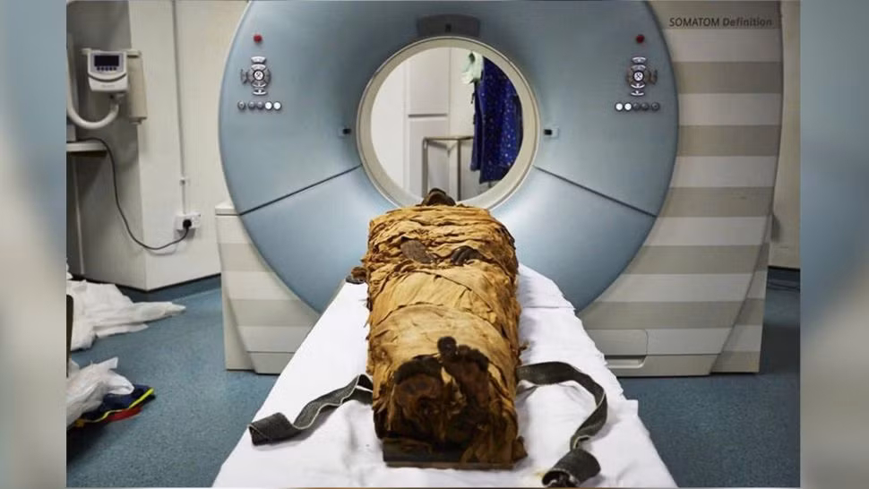 Tiet lo chan dong giong noi that cua xac uop Ai Cap