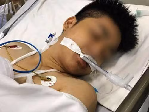 Dang truy tim ke chem chu cua hang dien thoai man ro