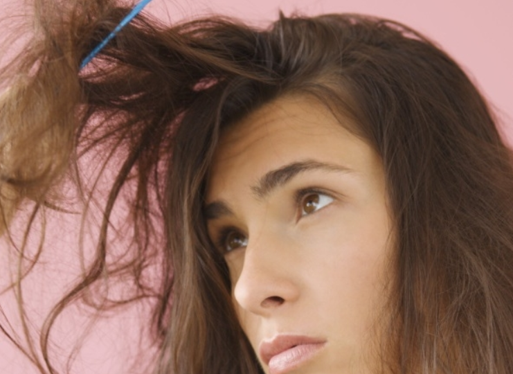 5 dau hieu nay xuat hien tren khuon mat de khuynh gia bai san