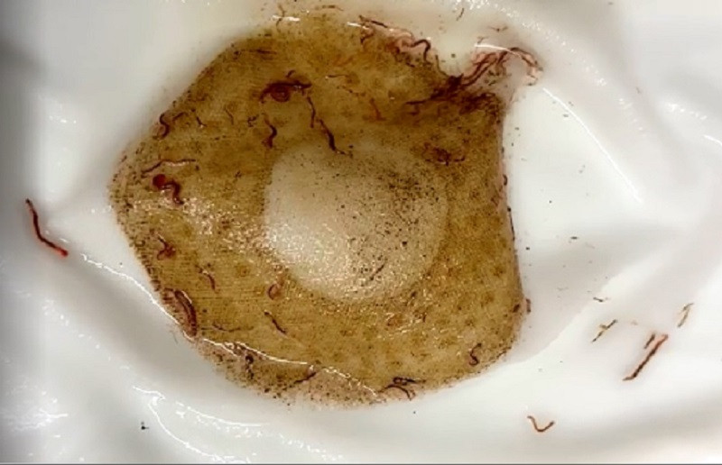 Duong nuoc sinh hoat KDT Phap Van - Tu Hiep day giun san: Cac ben lien quan noi gi?-Hinh-3