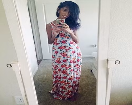 “Cho đến khi tôi đi học mẫu giáo tôi mới phát hiện bản thân không giống với những người khác, các bạn xa lánh tôi, không muốn ngồi với tôi”, Lizzie, người bị coi là cô gái xấu nhất hành tinh, chia sẻ. 