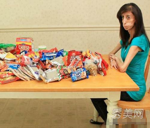 Năm 17 tuổi, Lizze vô tình phát hiện một đoạn video trên Youtube, trong đó chế giễu cô là “cô gái xấu nhất hành tinh”. Những lời bình luận vô cùng ác ý như “Tại sao cha mẹ cô không phá thai ngay từ nhỏ?” hay “Đốt chết cô gái đó đi” ở khắp mọi nơi làm cô đau đớn.