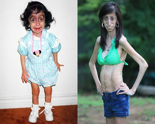 Tuy nhiên, gia đình luôn là động lực lớn nhất giúp Lizzie trở nên tích cực và lạc quan. Cô dần tham gia vào các hoạt động ngoại khóa, và kết bạn với nhiều người. 