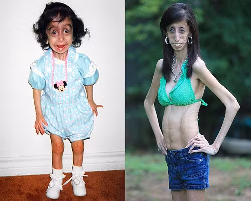 Tuy nhiên, gia đình luôn là động lực lớn nhất giúp Lizzie trở nên tích cực và lạc quan. Cô dần tham gia vào các hoạt động ngoại khóa, và kết bạn với nhiều người. 