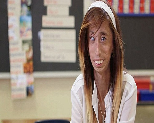 “Họ cũng thường xuyên chế giễu ngoại hình của tôi, thường chỉ trỏ và đem ra giễu cợt”, cô gái hóa bà lão hồi tưởng. 