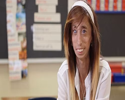 “Họ cũng thường xuyên chế giễu ngoại hình của tôi, thường chỉ trỏ và đem ra giễu cợt”, cô gái hóa bà lão hồi tưởng. 