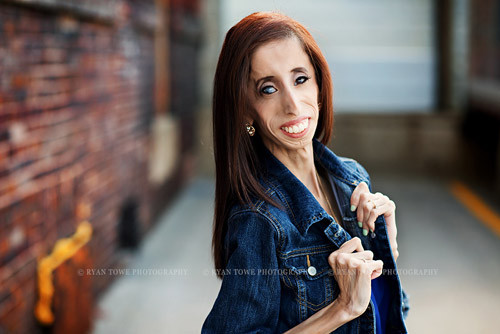 “Mặc dù đây là câu chuyện của tôi, nhưn vẫn còn rất nhiều người bị bắt nạt vì vẻ bề ngoài của mình, họ luôn có cảm giác không an toàn hoặc cảm thấy cô đơn”, cô nói. Cô cũng muốn nói với những người này rằng, chỉ cần nỗ lực không ngừng, đừng bao giờ bị lật đổ sẽ nhất định tìm thấy bình minh của cuộc đời. 