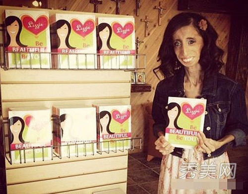 Lizze đọc tất cả các bình luận, nhưng đáng tiếc không ai đứng ra bênh vực cô. Từ đó cô không hề vấp ngã, cô nỗ lực học đại học, xuất bản sách, trở thành nhà hùng biện.