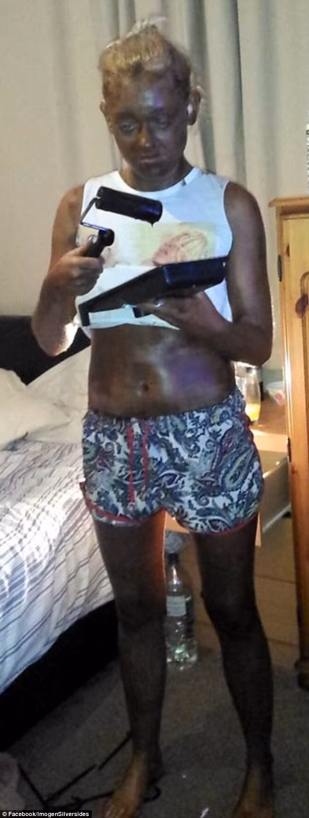 Nhưng không may, cách này đã không có hiệu quả như mong đợi. Làn da của cô trở nên loang lổ và có màu tối sầm bẩn thỉu. Tai nạn làm đẹp trớ trêu này khiến cô phải nghỉ làm nguyên mấy ngày.