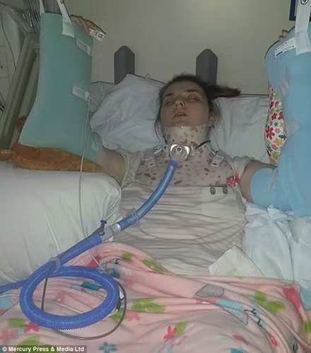 Theo các chuyên gia, tình trạng bệnh này sẽ khiến tuổi thọ của con người giảm chỉ còn 35-40 tuổi. Thế nhưng cô gái trẻ vẫn hết sức lạc quan. Darcey luôn đi điều trị mỗi tuần một lần để sửa khớp.