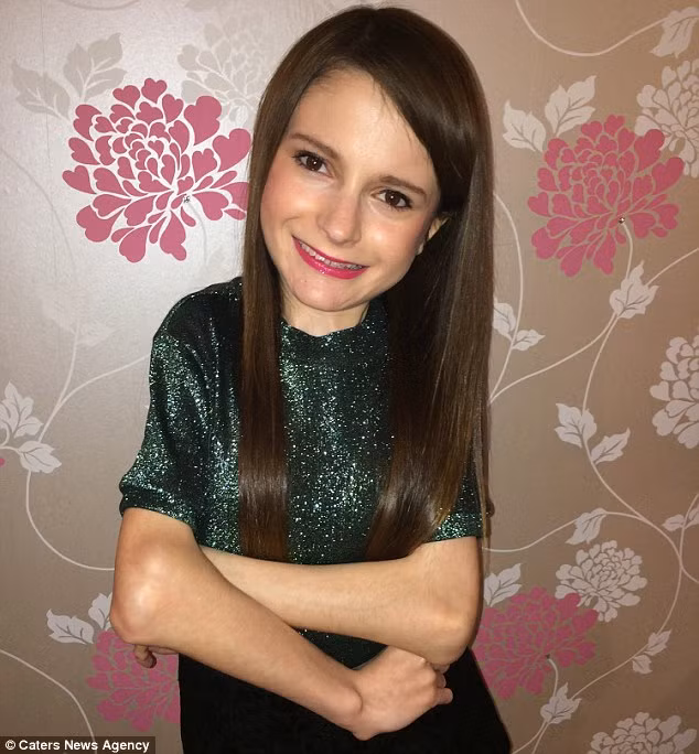 Luciana Wulkan, 17 tuổi, từ Bolton, mắc căn bệnh kỳ lạ khiến cơ thể bị đông cứng lại ở một vị trí. Căn bệnh "x ương hóa đá" có tên khoa học là Fibrodysplasia ossificans progressiva (FOP).