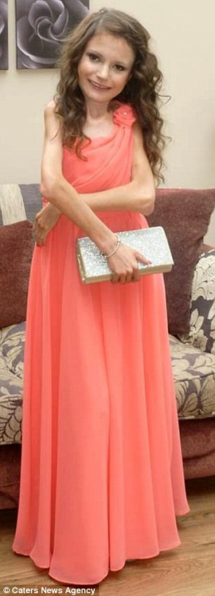 Nguyên nhân căn bệnh quái ác này là do cơ xương của những người mắc bệnh bị "xương hóa" khiến phần cơ của cô dần hóa đá, dần dần cơ thể sẽ đông cứng như bức tượng.