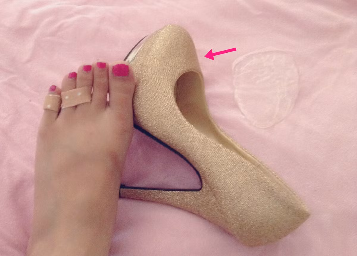 Đi giày cao gót không đau. Nếu bạn phải đi giày cao gót trong thời gian dài thì hãy dùng băng y tế cứu nguy. Hãy băng 2 ngón chân thứ 3 và 4 lại với nhau. Nó sẽ khiến đôi chân thoải mái hơn bởi giữa 2 ngón này có dây thần kinh phân khiến bàn chân gặp nhiều áp lực.