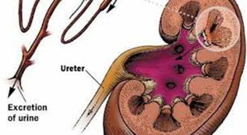 Sỏi thận. Do hầu hết các loại rau xanh đều có tính kiềm. Chất này khi kết hợp với các thực phẩm nhiều canxi sẽ tạo ra sỏi trong cơ thể. Vì thế mà những người có bệnh thận mãn tính hay suy thận không nên ăn nhiều rau, đặc biệt là cải bó xôi, cần tây, cà chua…