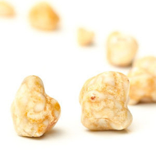 Sỏi mật. Là hạt cứng bị kẹt trong túi mật. Phụ nữ mang thai và phụ nữ thừa cân ở độ tuổi 40 rất dễ mắc bệnh này. Trong khi đó, gần một nửa số phụ nữ được dự kiến sẽ phát triển sỏi mật của tuổi 75, so với chỉ 20 phần trăm đàn ông.