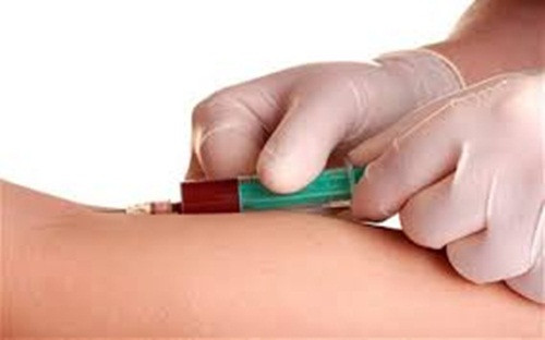 Tuyến giáp. Phụ nữ ở độ tuổi 50-60 rất dễ bị nhược giáp do tuyến giáp không sản xuất đủ hormone. Dấu hiệu thường là mệt mỏi, tăng cân và trầm cảm. Một xét nghiệm máu đo nồng độ hormone là cách chính xác duy nhất để tìm hiểu xem liệu có vấn đề gì hay không.