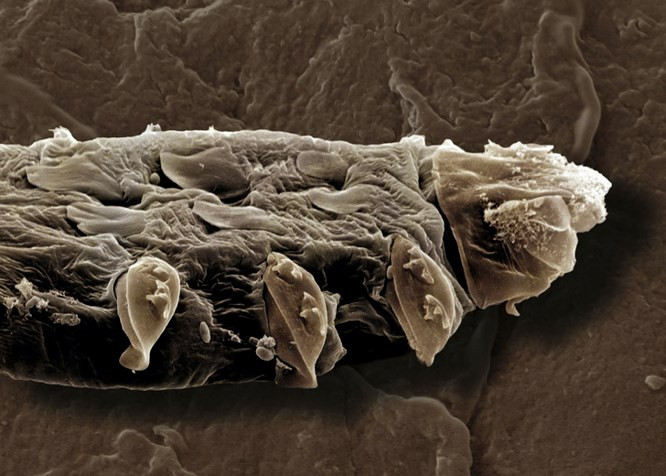  8. Ký sinh trùng sống trên da mặt người và ăn các tế bào: Đây là một thực tế đáng sợ khác. 1/3 trẻ em, 1/2 người lớn và 2/3 người cao tuổi có ký sinh trùng Demodex trên mặt. Hầu hết thời gian, nó sống bên trong hoặc gần các nang lông của lông mày, lông mi và mũi. Minh chứng cho sự sống của nó là các tế bào da và bã nhờn. Thông thường, nó không gây rắc rối gì cả, nhưng trong một số trường hợp (khi mọi người bị bệnh hoặc căng thẳng) số lượng Demodex tăng lên đáng kể dẫn đến bệnh về da demodicosis.