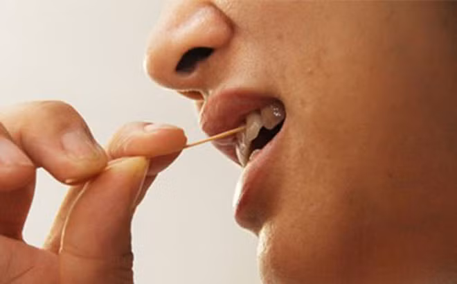 Nếu bạn thường xuyên dùng tăm ở cùng một vị trí trên răng trong thời gian dài còn có thể làm thưa răng. Ảnh: sohacdn.