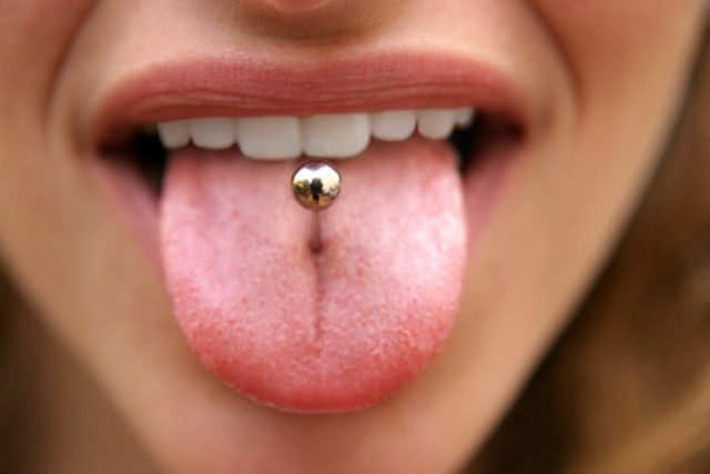 Ngoài ra, những người đeo khuyên lưỡi còn thường gặp tình trạng nứt hoặc sứt mẻ răng. Ảnh: bliblismiles.