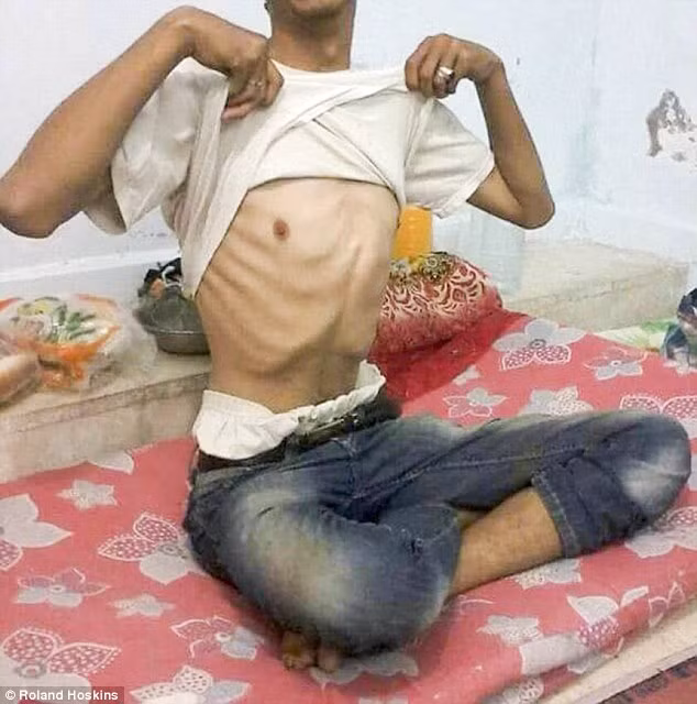 Canh tre nho chet doi dau long tai TP Deir Ezzor, Syria-Hinh-7