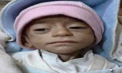 Canh tre nho chet doi dau long tai TP Deir Ezzor, Syria-Hinh-3